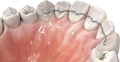 prime4me® RETAIN3R maxilar