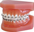 Modelo de ortodoncia para demostraciones discovery® smart sl