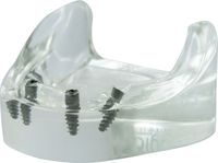Modelo de demostración acrílico, tioLogic® TWINFIT, maxilar inf., sin dientes, 4 implantes, sin prótesis