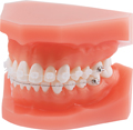 Modelo de ortodoncia para demostraciones discovery® pearl