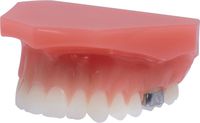 Modelo de ortodoncia para demostraciones tomas®/amda®