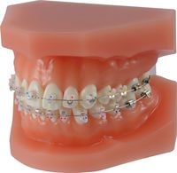 Modelo de ortodoncia para demostraciones dinamique® c